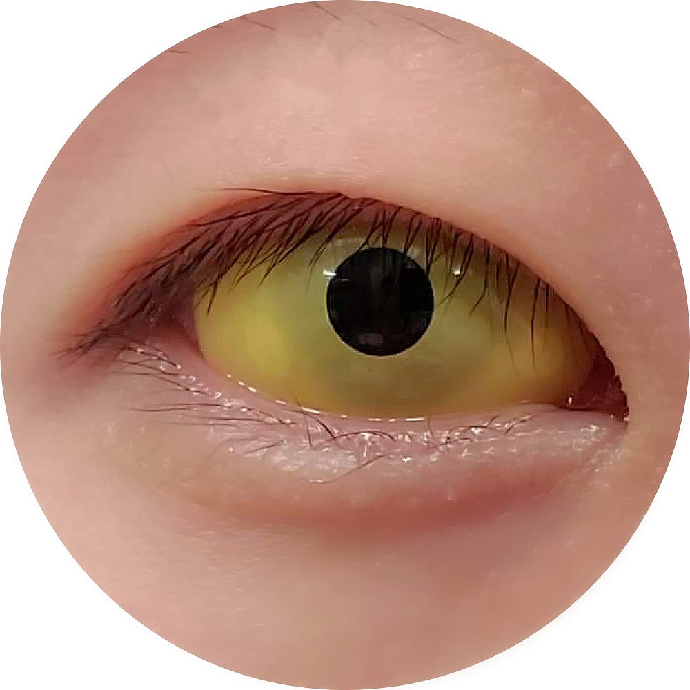 Sweety Yellow Sclera Contacts (1 lens/pack)-Sclera Contacts-UNIQSO