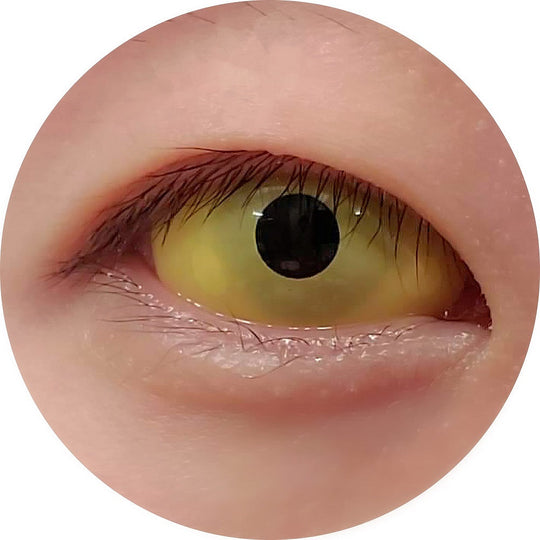 CrazyLab 22mm Yellow Sclera (2 lenses/pack)
